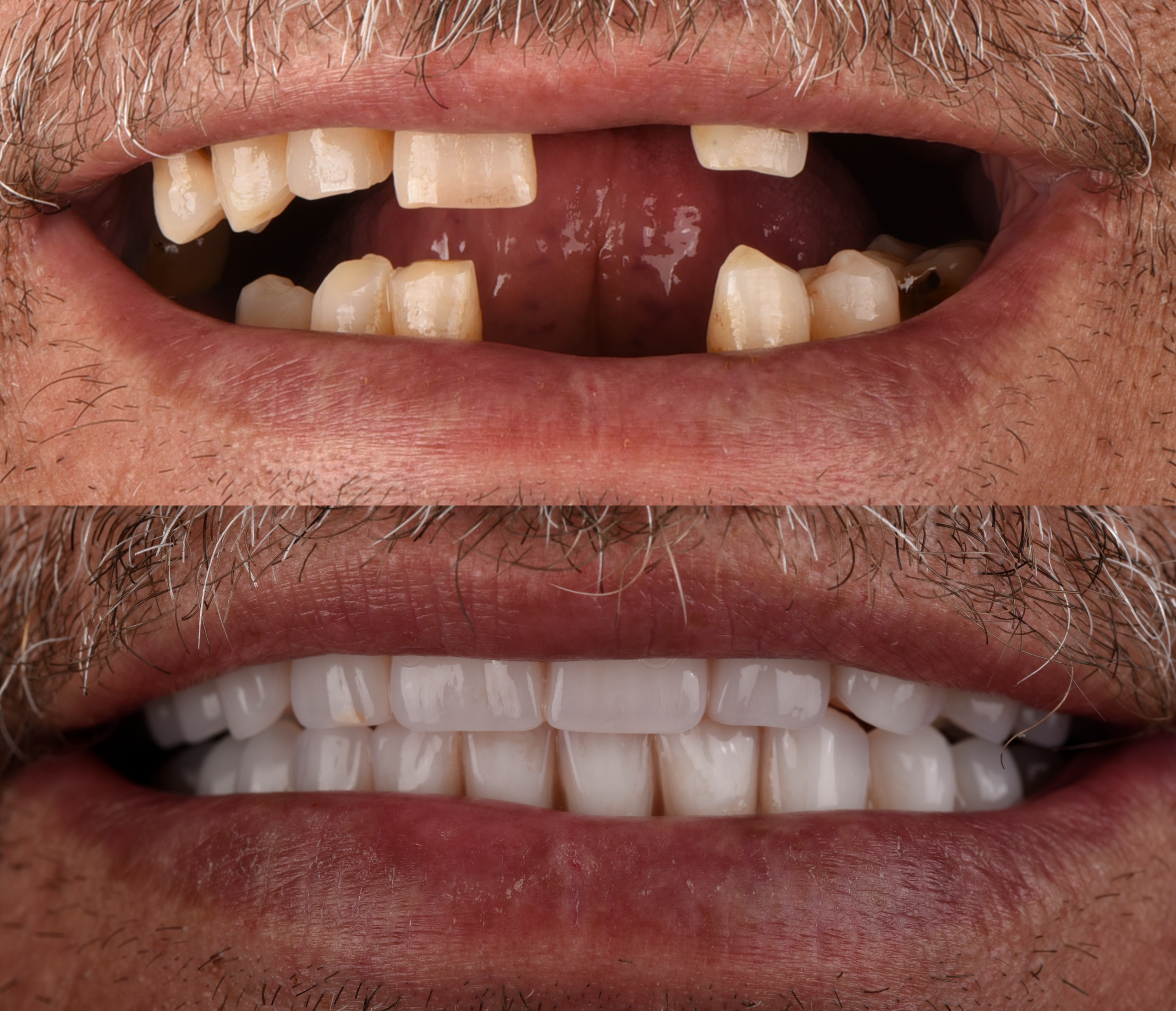 Boris Dimevski B&A 02