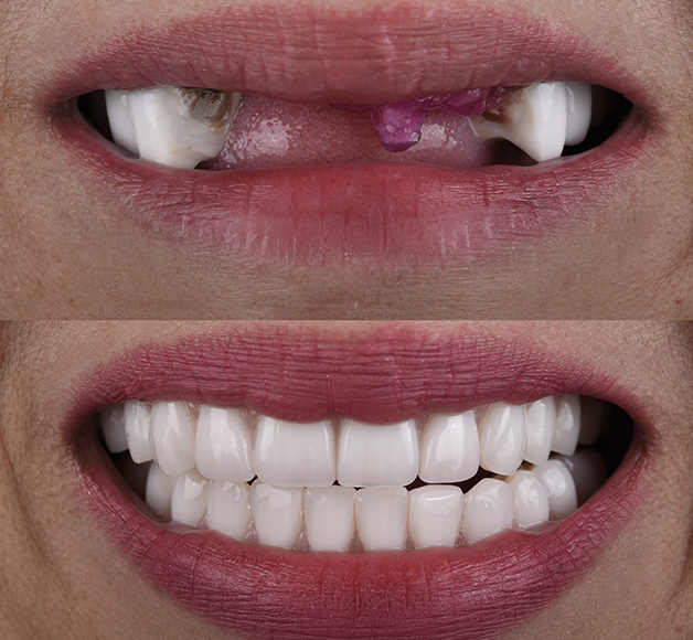 dental-img-v3