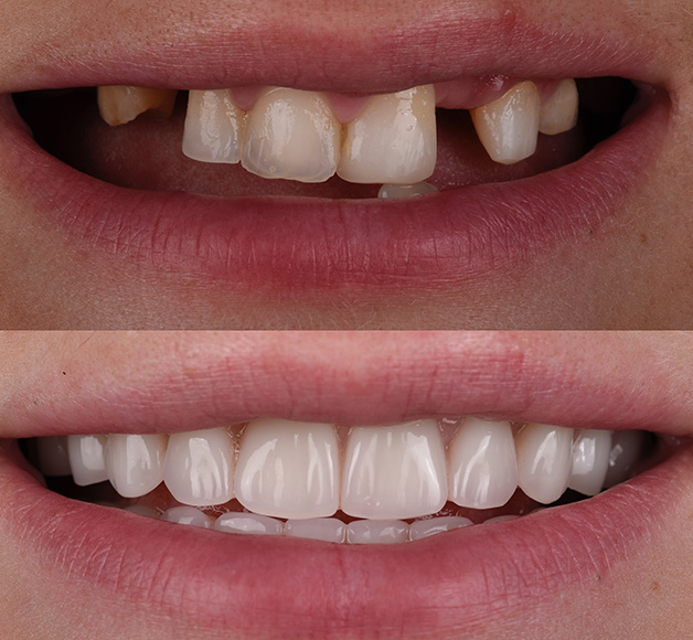 dental-img-v6